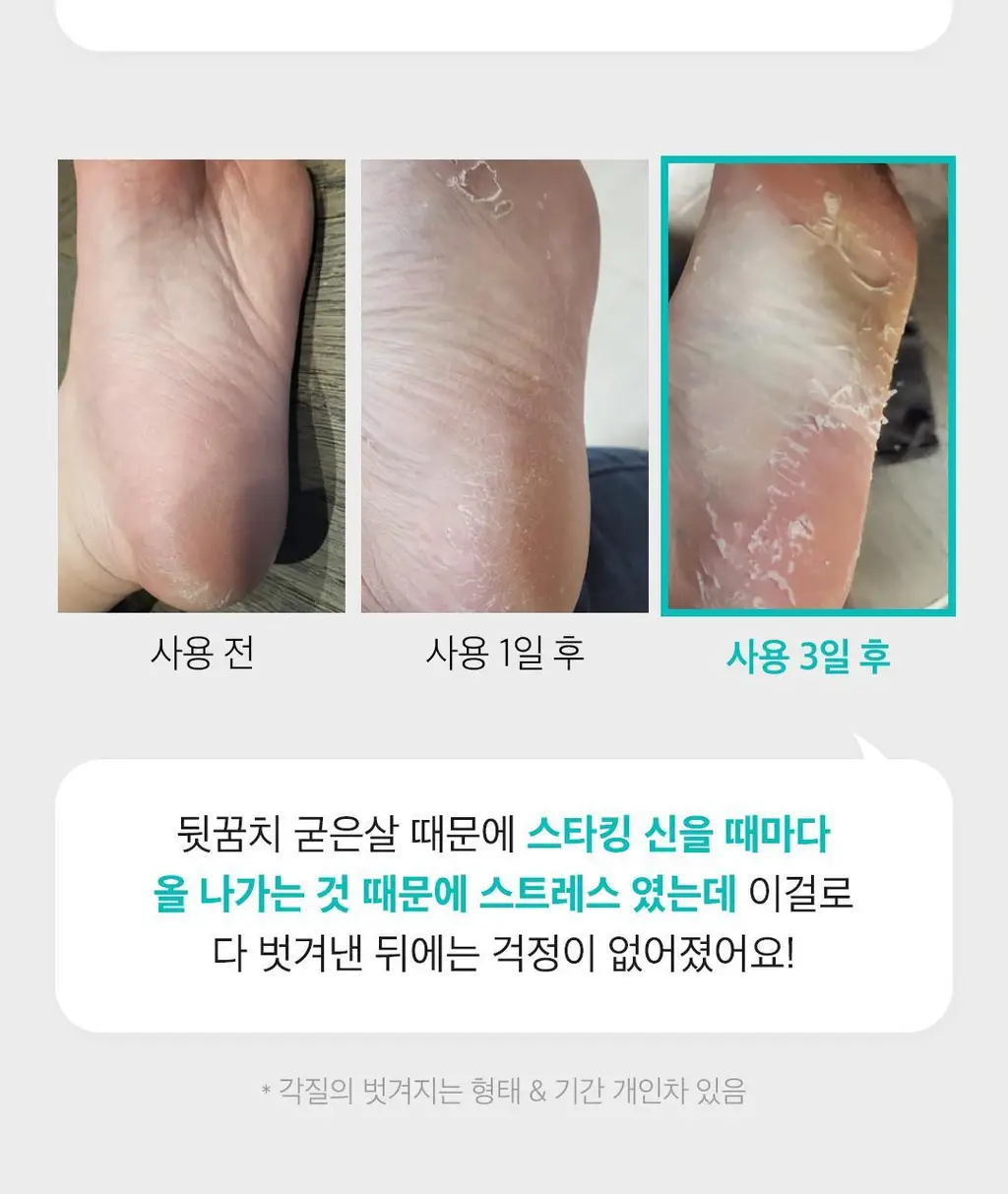 [발허물팩]아리얼 스무스앤퓨어 풋 필링 마스크 상세페이지 9